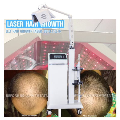 Trị liệu tóc LLLT Liệu pháp laser Phát triển tóc bằng Real Diodes Laser Hair Regrowth Machine