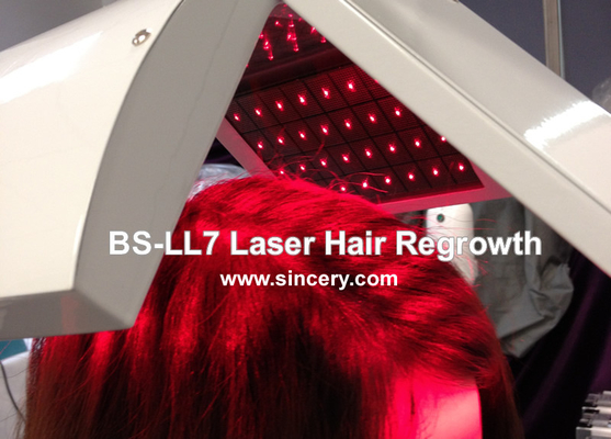 Thiết bị Laser Diode dọc 650nm để mọc lại lông