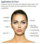 HIFU Beauty Device Skin Lift Face Wrinkle Remover Machine Non - Invasive