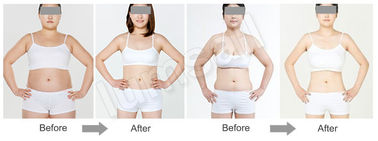 Lipo Massage siêu âm Cavites Máy giảm béo cơ thể để định hình / giảm cân