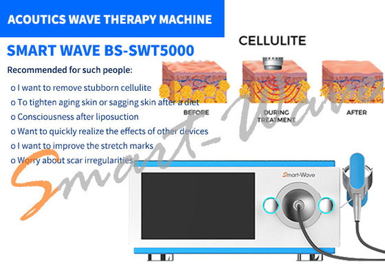 6 Máy phát sóng Liệu pháp sóng âm để loại bỏ vết rạn da / Định hình lại cơ thể