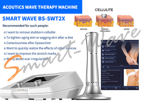 Beauty Salon BS-SWT2X Máy trị liệu bằng sóng âm Loại bỏ Cellulite 1 năm Bảo hành