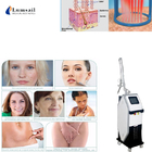 Gynecology CO2 Fractional Laser Machine For Vaginal Tightening