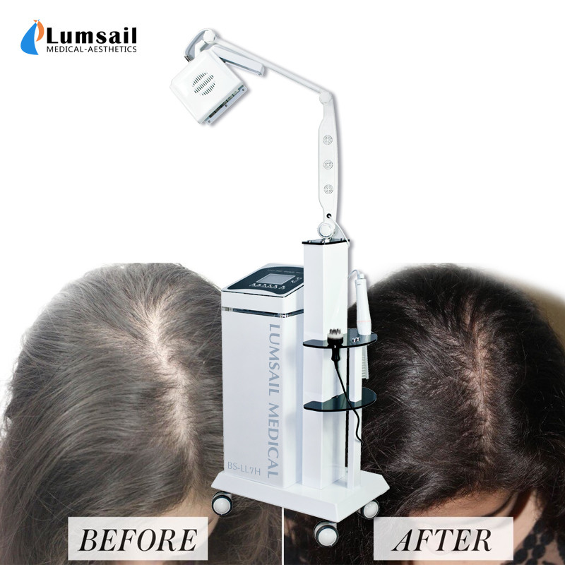 Handheld Probe 650nm Hair Loss Diode Laser Machine